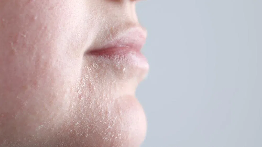 Korneoterapia Dermaviduals - odbudowa bariery hydrolipidowej w Studio Beauty Plan